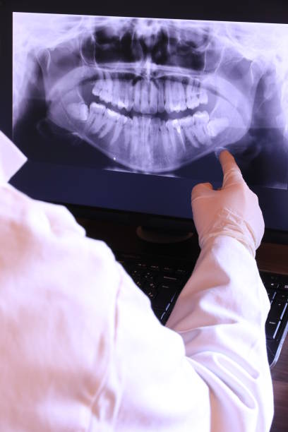 Best Emergency Dentist for Lost Fillings or Crowns in Lake Mills, WI